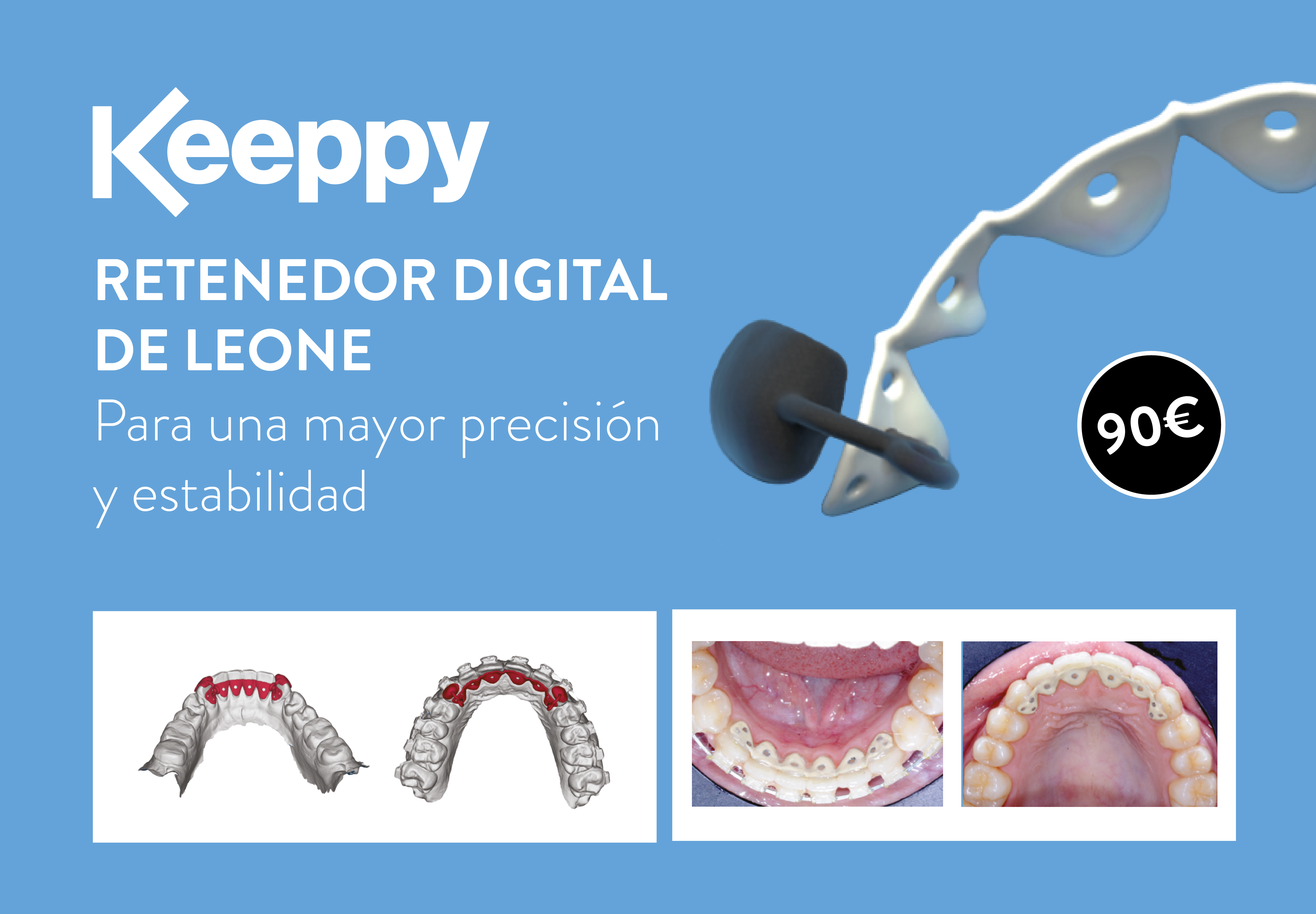 Keeppy: El nuevo retenedor totalmente digital